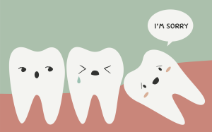 wisdom-teeth-removal-dentist-summerland-dental